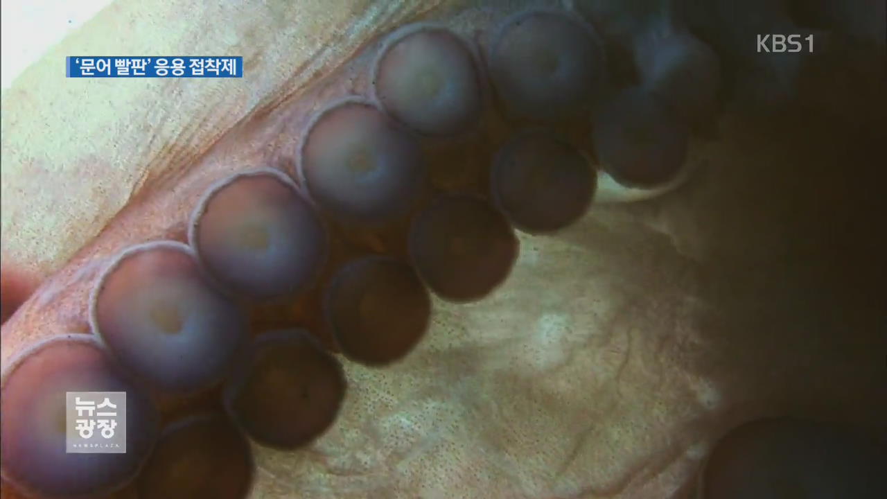 문어 빨판 구조 이용한 접착 패치 개발