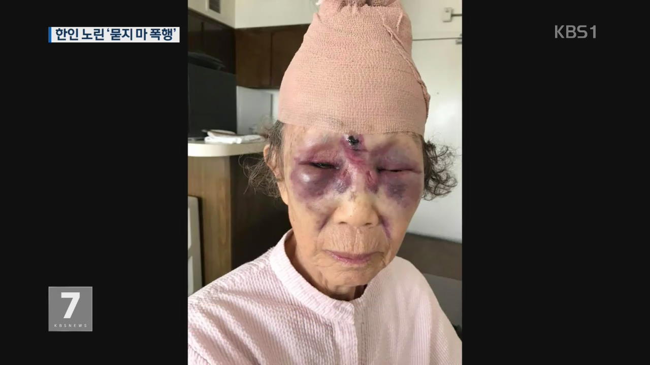 LA 한인타운서 80대 노인 ‘묻지마 폭행’ 당해
