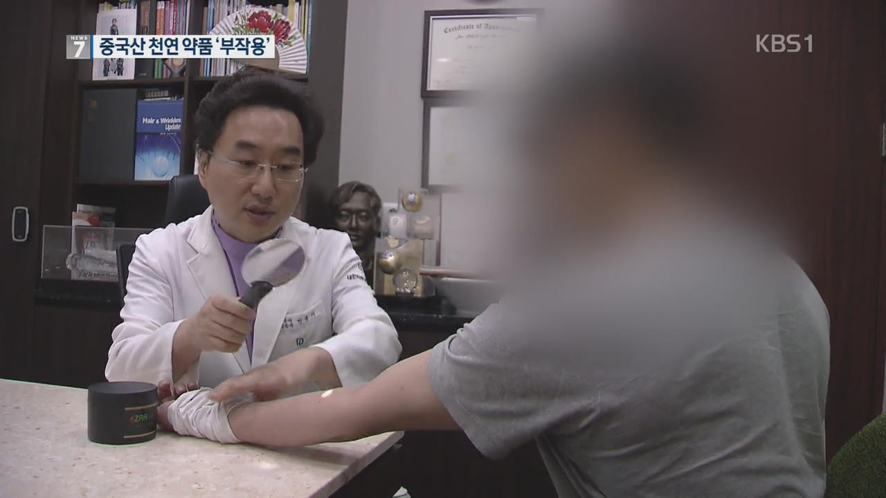 ‘천연이라더니 스테로이드’…중국산 크림 부작용 호소