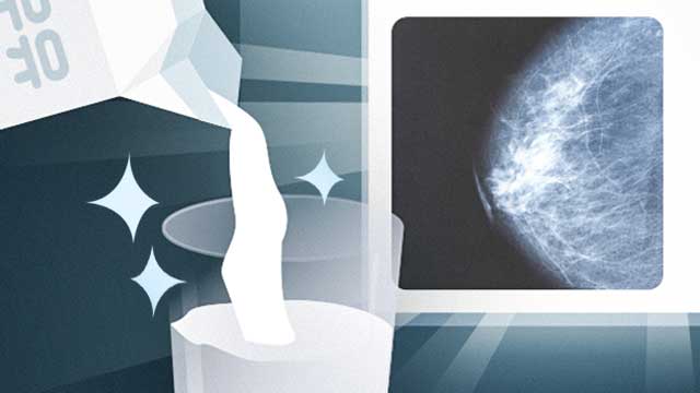 “우유가 유방암 일으킨다?”…오히려 예방에 도움